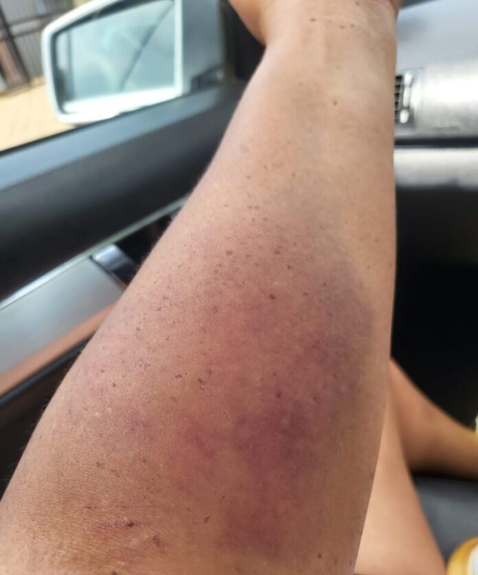 Six Free State caregivers charged with assaulting 81-year-old