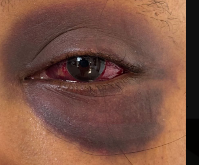 Outcry over GBV incident pushes police to act