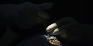 Surgeon performing cataract surgery on a patient in a medical operating room